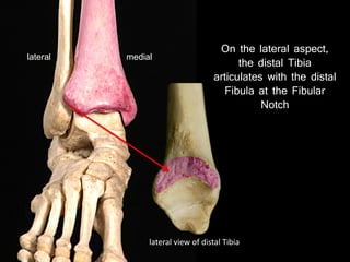 On the lateral aspect,
the distal Tibia
articulates with the distal
Fibula at the Fibular
Notch
mediallateral
lateral view of distal Tibia
 
