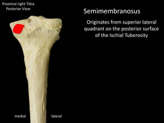 Semimembranosus
Originates from superior lateral
quadrant on the posterior surface
of the Ischial Tuberosity
Proximal right Tibia
Posterior View
lateralmedial
 
