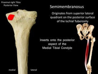 Semimembranosus
Originates from superior lateral
quadrant on the posterior surface
of the Ischial Tuberosity
Inserts onto the posterior
aspect of the
Medial Tibial Condyle
Proximal right Tibia
Posterior View
lateralmedial
 