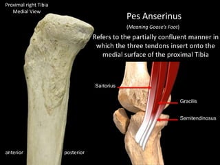 posterioranterior
Pes Anserinus
Sartorius
Gracilis
Semitendinosus
(Meaning Goose’s Foot)
Refers to the partially confluent manner in
which the three tendons insert onto the
medial surface of the proximal Tibia
Proximal right Tibia
Medial View
 