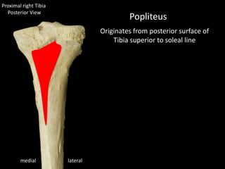 Proximal right Tibia
Posterior View
lateralmedial
Popliteus
Originates from posterior surface of
Tibia superior to soleal line
 