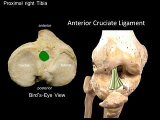Proximal right Tibia
posterior
anterior Anterior Cruciate Ligament
Bird’s-Eye View
medial lateral
 