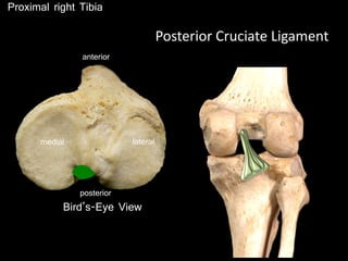 Proximal right Tibia
posterior
anterior
Posterior Cruciate Ligament
Bird’s-Eye View
medial lateral
 