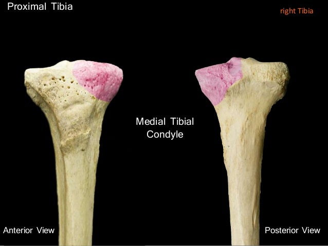 Slideshow: Tibia