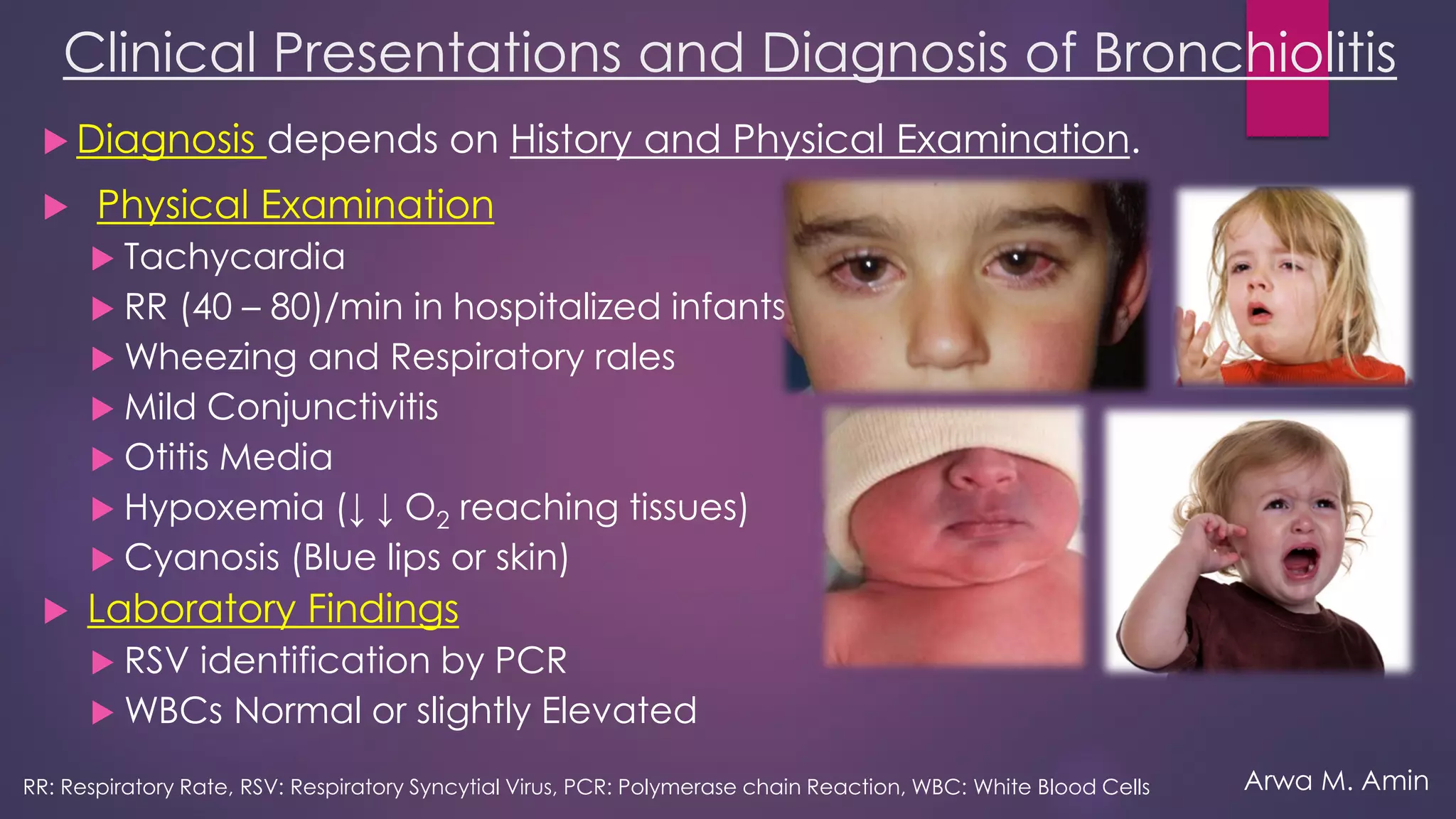 Bronchiolitis: An overview | PDF