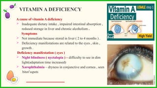 A cause of vitamin A deficiency
 Inadequate dietary intake , impaired intestinal absorption ,
redused storage in liver and chronic alcoholism .
Symptoms
 Not immediate because stored in liver ( 2 to 4 months ) .
 Defeciency manifestations are related to the eyes , skin ,
growth .
Deficiency manifestation ( eyes )
 Night blindness ( nyctalopia ) – difficulty to see in dim
light(adaptation time increased)
 Xarophthalmia – dryness in conjunctive and cornea , seen
bitot’sspots
VITAMIN A DEFICIENCY
 
