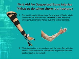 5. The most important thing to do for any type of fracture is to
immobilize the affected area. IMMOBILIZATION means
limiting movement and hence avoiding further damage.
6. While the patient is immobilized, call for help. Stay with the
patient. Make him/her as comfortable as possible with the
least amount of movement.
 