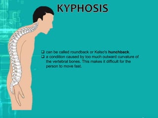  can be called roundback or Kelso's hunchback.
 a condition caused by too much outward curvature of
the vertebral bones. This makes it difficult for the
person to move fast.
 