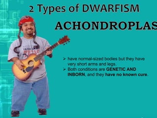  have normal-sized bodies but they have
very short arms and legs.
 Both conditions are GENETIC AND
INBORN, and they have no known cure.
 
