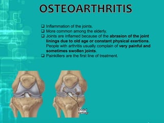  Inflammation of the joints.
 More common among the elderly.
 Joints are inflamed because of the abrasion of the joint
linings due to old age or constant physical exertions.
People with arthritis usually complain of very painful and
sometimes swollen joints.
 Painkillers are the first line of treatment.
 