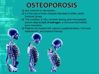  very common in old women.
 It is the loss of bone minerals that lead to brittle, easily
fractured bones.
 This condition is very common among post-menopausal
women due to lack of estrogen, a hormone that inhibits
bone resorption.
 Patients are treated with calcium supplementation, hormone
replacement, and physical therapy.
 