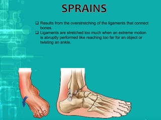  Results from the overstretching of the ligaments that connect
bones.
 Ligaments are stretched too much when an extreme motion
is abruptly performed like reaching too far for an object or
twisting an ankle.
 