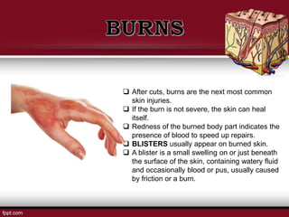  After cuts, burns are the next most common
skin injuries.
 If the burn is not severe, the skin can heal
itself.
 Redness of the burned body part indicates the
presence of blood to speed up repairs.
 BLISTERS usually appear on burned skin.
 A blister is a small swelling on or just beneath
the surface of the skin, containing watery fluid
and occasionally blood or pus, usually caused
by friction or a burn.
 