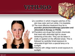  a condition in which irregular patches of the
skin lose color and turn white. It is treatable.
 The most effective treatment thus far is
psoralen photochemotherapy (psoralen and
ultraviolet-A therapy or PUVA).
 Psoralens are drugs that contain chemicals
that react with ultraviolet light to cause
darkening of the skin. They can be taken in
orally or applied on the affected areas. This is
followed by carefully timed exposure to
ultraviolet-A light from a special lamp or to
sunlight.
 Patients with vitiligo need to avoid exposure to
sunlight.
 