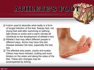  A term used to describe what really is a form
of fungal infection of the feet. Sweaty feet, not
drying feet well after swimming or bathing,
tight shoes or socks and a warm climate all
contribute to the development of athlete’s foot.
 Athlete’s foot may affect different people in
different ways. Some may have this skin
disease between the toes, especially the last
two.
 The affected area peels, cracks and scales.
Others may have redness, scaling and even
blisters on the soles and along the sides of the
feet. These skin changes may be
accompanied by itching.
 