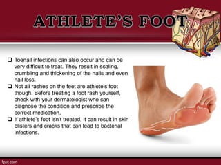  Toenail infections can also occur and can be
very difficult to treat. They result in scaling,
crumbling and thickening of the nails and even
nail loss.
 Not all rashes on the feet are athlete’s foot
though. Before treating a foot rash yourself,
check with your dermatologist who can
diagnose the condition and prescribe the
correct medication.
 If athlete’s foot isn’t treated, it can result in skin
blisters and cracks that can lead to bacterial
infections.
 
