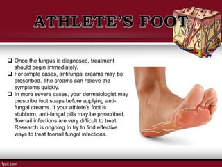  Once the fungus is diagnosed, treatment
should begin immediately.
 For simple cases, antifungal creams may be
prescribed. The creams can relieve the
symptoms quickly.
 In more severe cases, your dermatologist may
prescribe foot soaps before applying anti-
fungal creams. If your athlete’s foot is
stubborn, anti-fungal pills may be prescribed.
Toenail infections are very difficult to treat.
Research is ongoing to try to find effective
ways to treat toenail fungal infections.
 
