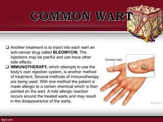  Another treatment is to inject into each wart an
anti-cancer drug called BLEOMYCIN. The
injections may be painful and can have other
side effects.
 IMMUNOTHERAPY, which attempts to use the
body’s own rejection system, is another method
of treatment. Several methods of immunotherapy
are being used. With one method the patient is
made allergic to a certain chemical which is then
painted on the wart. A mild allergic reaction
occurs around the treated warts and may result
in the disappearance of the warts.
 