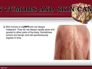  Skin tumors or LUMPS are not always
malignant. They do not always rapidly grow and
spread to other parts of the body. Sometimes,
tumors are benign and will spontaneously
regress in time.
 