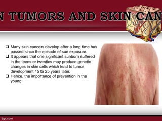  Many skin cancers develop after a long time has
passed since the episode of sun exposure.
 It appears that one significant sunburn suffered
in the teens or twenties may produce genetic
changes in skin cells which lead to tumor
development 15 to 25 years later.
 Hence, the importance of prevention in the
young.
 