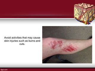 Avoid activities that may cause
skin injuries such as burns and
cuts.
 
