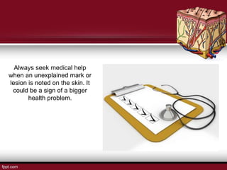 Always seek medical help
when an unexplained mark or
lesion is noted on the skin. It
could be a sign of a bigger
health problem.
 