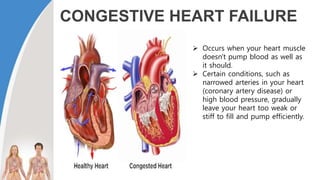 CONGESTIVE HEART FAILURE
 Occurs when your heart muscle
doesn't pump blood as well as
it should.
 Certain conditions, such as
narrowed arteries in your heart
(coronary artery disease) or
high blood pressure, gradually
leave your heart too weak or
stiff to fill and pump efficiently.
 