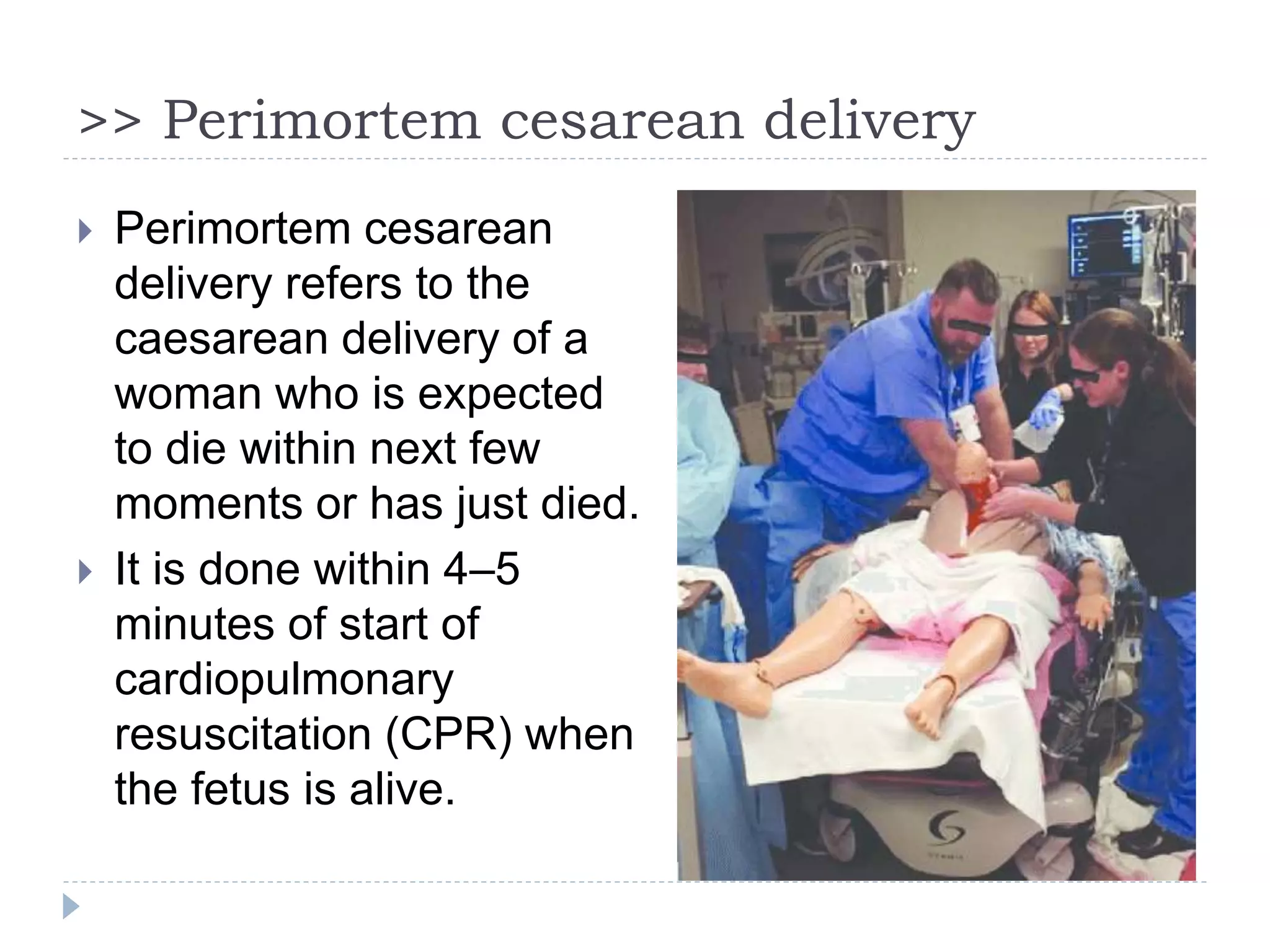 >> Perimortem cesarean delivery
 Perimortem cesarean
delivery refers to the
caesarean delivery of a
woman who is expected
to die within next few
moments or has just died.
 It is done within 4–5
minutes of start of
cardiopulmonary
resuscitation (CPR) when
the fetus is alive.
 