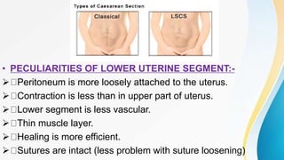 lscs ppt.pptx