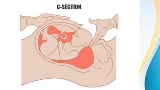 Lscs Labour lscs ppt.pptx