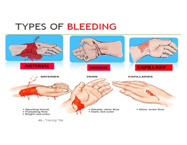 Lecture 7: first aid, choke, CPR, diabetes, bleed, burn