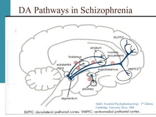 DA Pathways in Schizophrenia
 