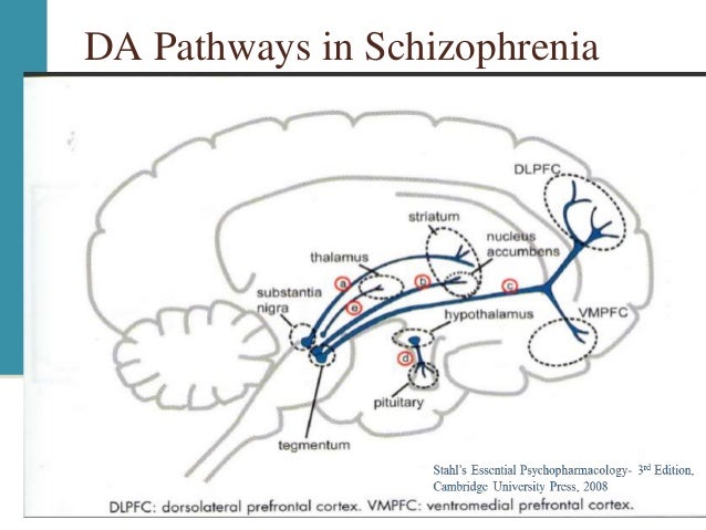 Schizophrenia ppt Schizophrenia ppt
