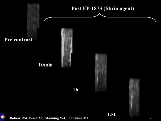 mr contrast agent