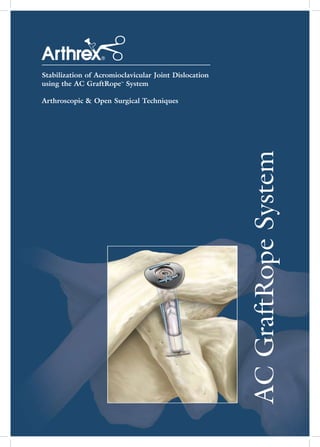 Stabilization of Acromioclavicular Joint Dislocation
using the AC GraftRope™ System

Arthroscopic & Open Surgical Techniques




                                                       AC GraftRope System
 