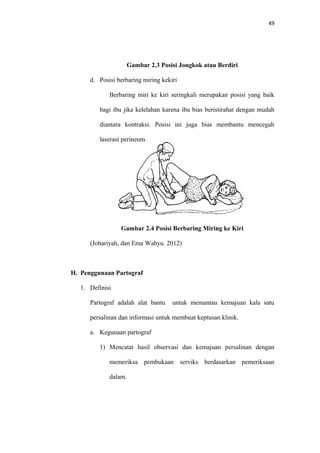 49
Gambar 2.3 Posisi Jongkok atau Berdiri
d. Posisi berbaring miring kekiri
Berbaring miri ke kiri seringkali merupakan posisi yang baik
bagi ibu jika kelelahan karena ibu bias beristirahat dengan mudah
diantara kontraksi. Posisi ini juga bias membantu mencegah
laserasi perineum.
Gambar 2.4 Posisi Berbaring Miring ke Kiri
(Johariyah, dan Ema Wahyu. 2012)
H. Penggunaan Partograf
1. Definisi
Partograf adalah alat bantu untuk memantau kemajuan kala satu
persalinan dan informasi untuk membuat keptusan klinik.
a. Kegunaan partograf
1) Mencatat hasil observasi dan kemajuan persalinan dengan
memeriksa pembukaan serviks berdasarkan pemeriksaan
dalam.
 