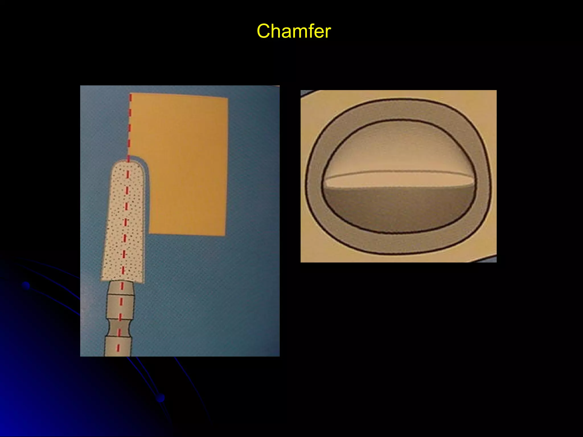 Linea terminal, Impresiones, Provisional | PPT
