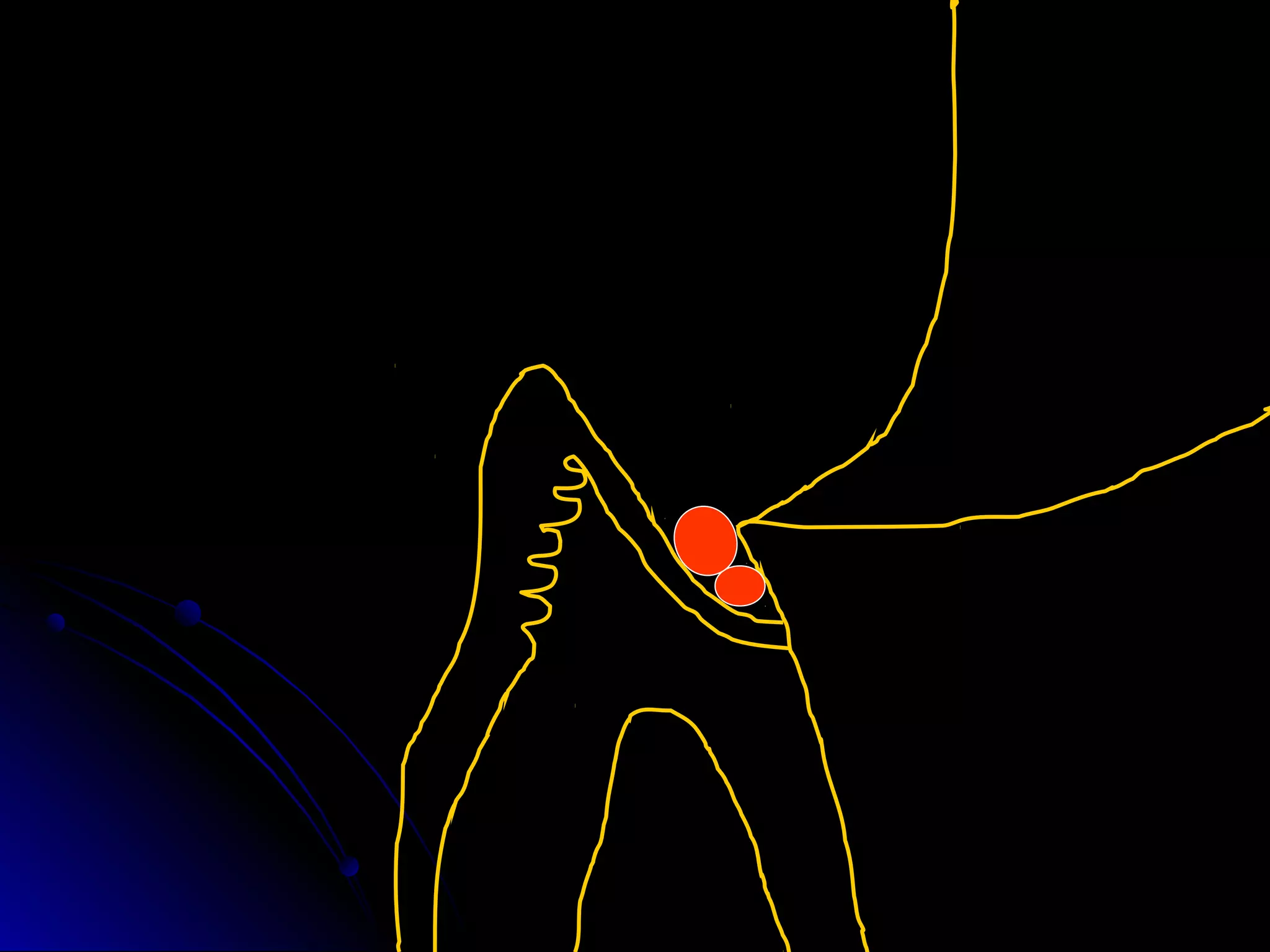 Linea terminal, Impresiones, Provisional | PPT