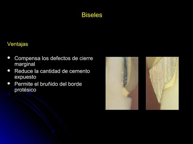 Linea terminal, Impresiones, Provisional | PPT