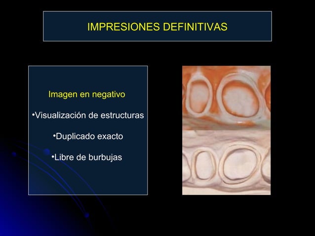 Linea terminal, Impresiones, Provisional | PPT