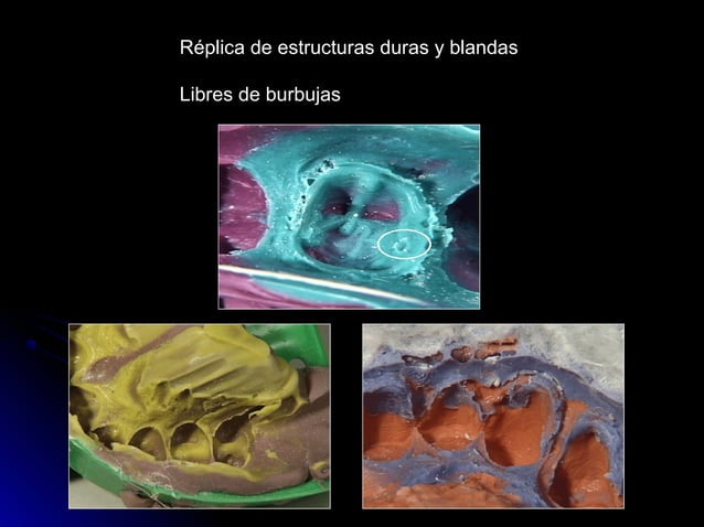 Linea terminal, Impresiones, Provisional | PPT