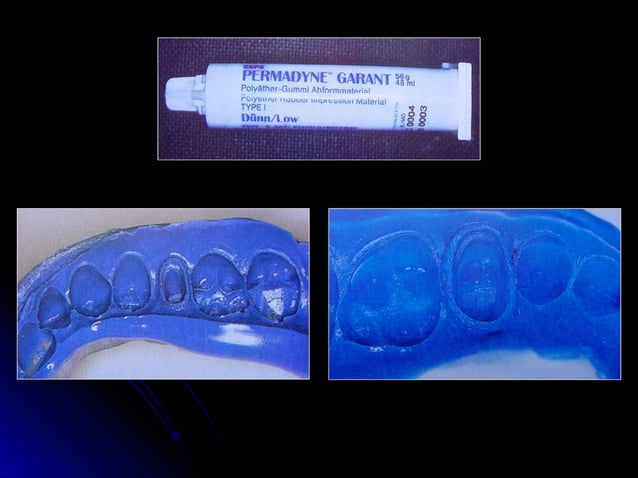 Linea terminal, Impresiones, Provisional | PPT