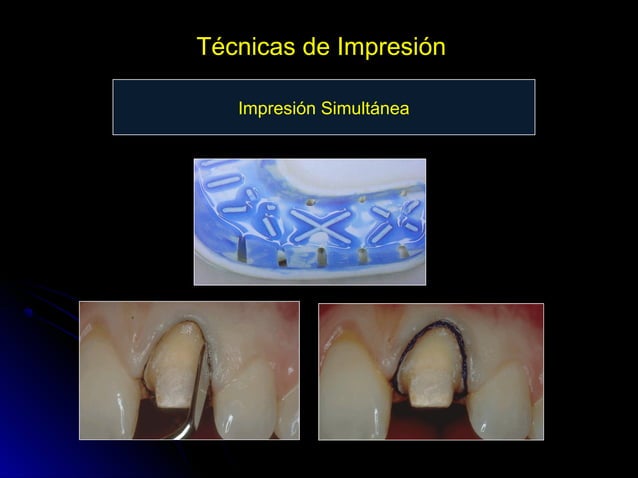 Linea terminal, Impresiones, Provisional | PPT