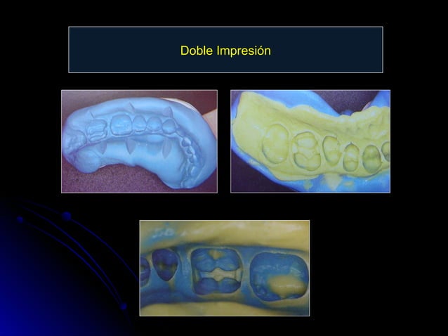 Linea terminal, Impresiones, Provisional | PPT