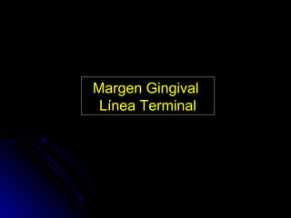 Margen Gingival
 Línea Terminal
 