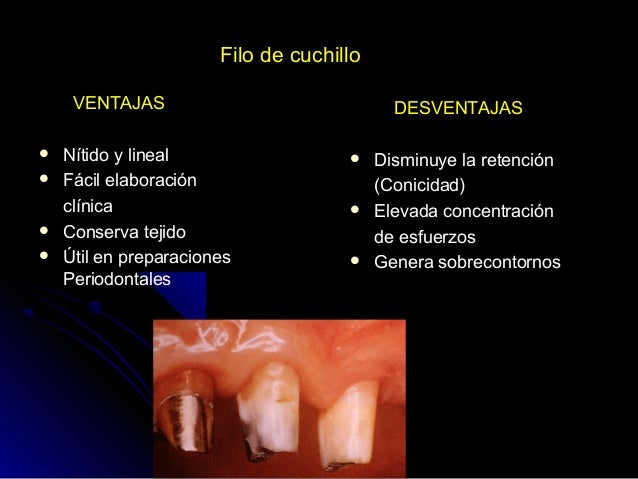 lineas terminales, impresiones definitivas, provisional