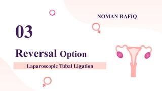 Noman Rafiq Lab Laparoscopic tubal ligation procedure by dr.Rehan | PPTX