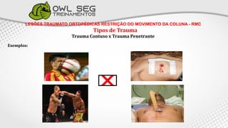 LESÕES TRAUMATO ORTOPÉDICAS RESTRIÇÃO DO MOVIMENTO DA COLUNA - RMC
Tipos de Trauma
Trauma Contuso x Trauma Penetrante
Exemplos:
 