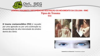 LESÕES TRAUMATO ORTOPÉDICAS RESTRIÇÃO DO MOVIMENTO DA COLUNA - RMC
Tipos de Trauma
TCE
O trauma cranioencefálico (TCE) é causado
por uma agressão ou por uma aceleração ou
desaceleração de alta intensidade do cérebro
dentro do crânio.
Assimetrica ou Anisocoria: Traumatismo craniano
 
