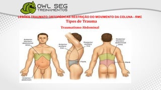 LESÕES TRAUMATO ORTOPÉDICAS RESTRIÇÃO DO MOVIMENTO DA COLUNA - RMC
Tipos de Trauma
Traumatismo Abdominal
 